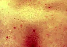 Cindy Takes Anal Enema Hairbrush and Fingers for Gaping Ass Prolapse