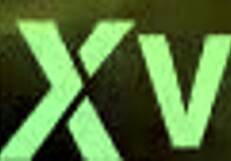 New Tattoo With Braces