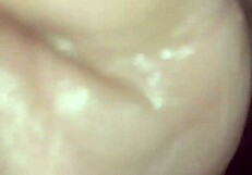 Lifeisanal Prolapse Objective 5!