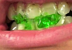 Watch Fifi Foxx Perform Mouth Vore On Gummy Bears Up Close!