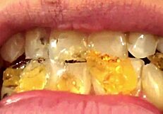 Watch Fifi Foxx Perform Mouth Vore On Gummy Bears Up Close!