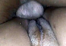 पेशेंट को हॉस्पिटल में चॉकलेट ग्लेज ट्रीटमेंट मिला