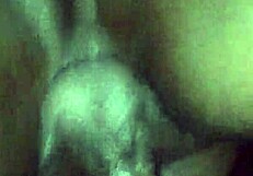 पेशेंट को हॉस्पिटल में चॉकलेट ग्लेज ट्रीटमेंट मिला