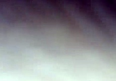 पेशेंट को हॉस्पिटल में चॉकलेट ग्लेज ट्रीटमेंट मिला