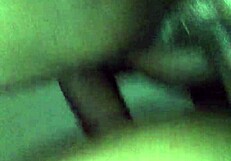 The patient receives a chocolate glaze treatment in the hospital