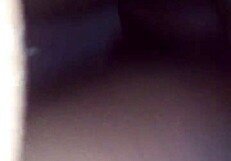 The patient receives a chocolate glaze treatment in the hospital