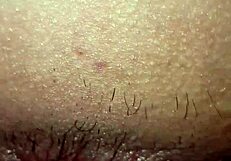 Torres takes it in the ass