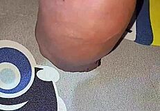 myanmar gay guy gets homemade saline injection for bigger cock