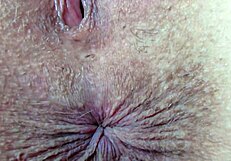 फेटिश फैंस के लिए जंगली गंद के फिंगरिंग का एक्सट्रीम क्लोजअप