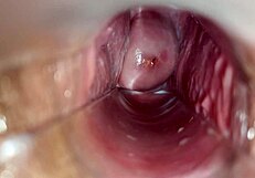 देखो इस चूत के अंदर ऑर्गेज्म का क्लोज-अप