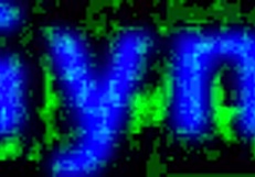 Dr. Tampa Performs Genesis' First Gyno Exam in Florida