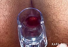 Anal vision speculum gaping that huge ass!