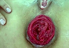 Destroyed anal juicy prolapse close up asshole