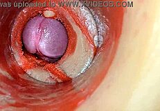 Huge Ejaculation Floods Deep Inside - Internal Camera Catches Every Creampie Drop!